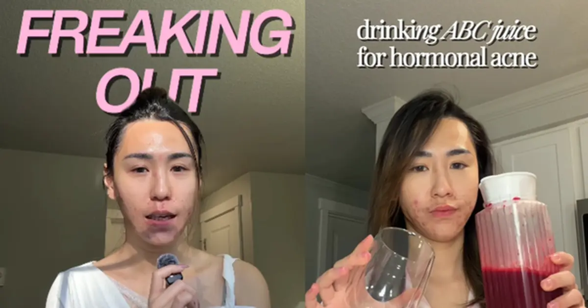 bi-quyet-lan-da-khoe-tu-cau-chuyen-cua-yunnie-tam-quan-trong-cua-giac